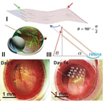 A method for single-neuron chronic recording from the retina in awake mice